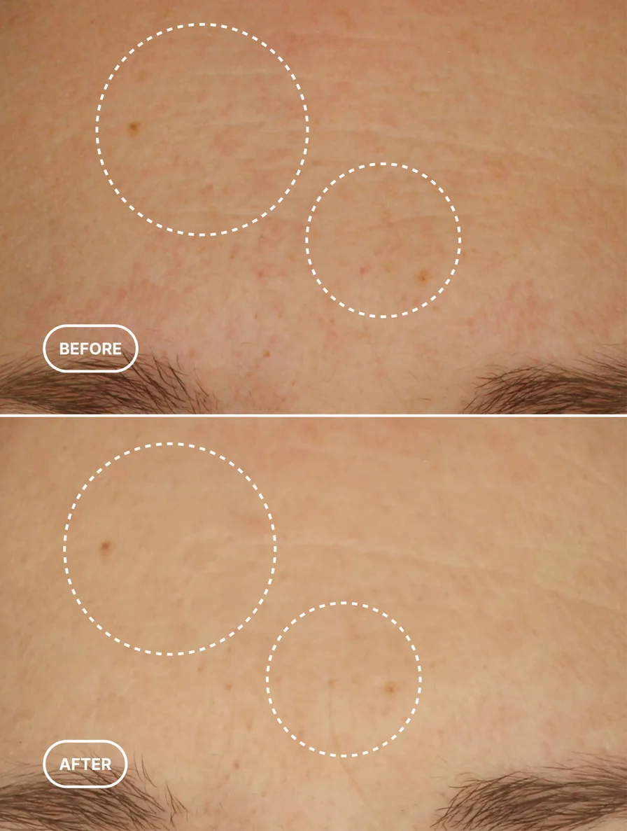 Natural Retinol Alternative Oil Serum Selfnamed