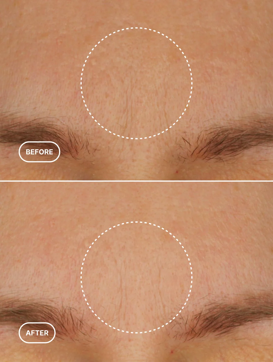 Retinol Alternative Natural Moisturiser Selfnamed