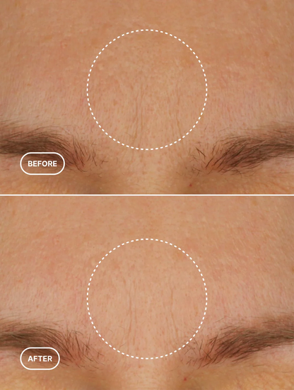 Retinol Alternative Natural Moisturiser Selfnamed